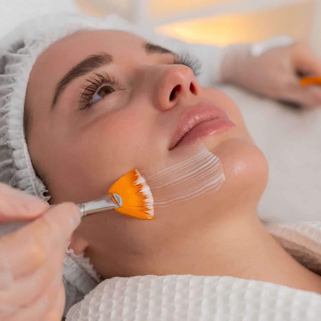 Peeling Químico